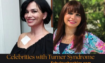 Celebrities with Turner Syndrome